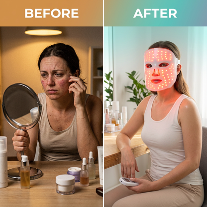 TheraGlow Mask2Go™ Red Light Therapy LED Face Mask — Before & After